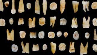 Teeth reveal modern humans in Asia 80,000 years ago