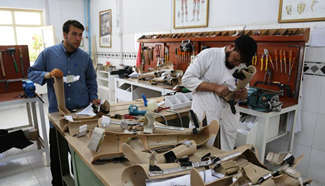 Pic story: war victims at Orthopedic Center of ICRC in Kabul