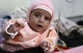 Children receive medical treatment at malnutrition care center in Yemen