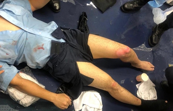 One police officer seriously injured by gasoline bombs in Hong Kong