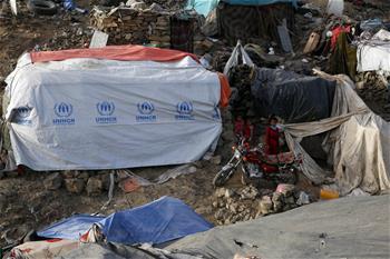 Daily life of Yemeni people at displaced camp in Sanaa