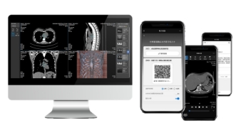 医学胶片怎么处理易联众智慧云胶片平台 助推医学影像服务“向云端”_https://www.jmylbn.com_新闻资讯_第3张
