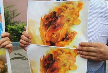 孕妇与侄女吃肯德基后双双中毒 公司暂无说法