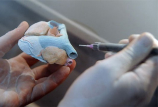 3D打印人工心脏