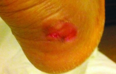 CBA球员抱怨李宁球鞋质量太差 后脚跟险被磨烂