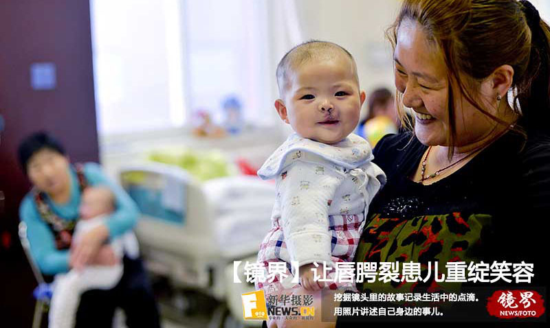【镜界】让唇腭裂患儿重绽笑容