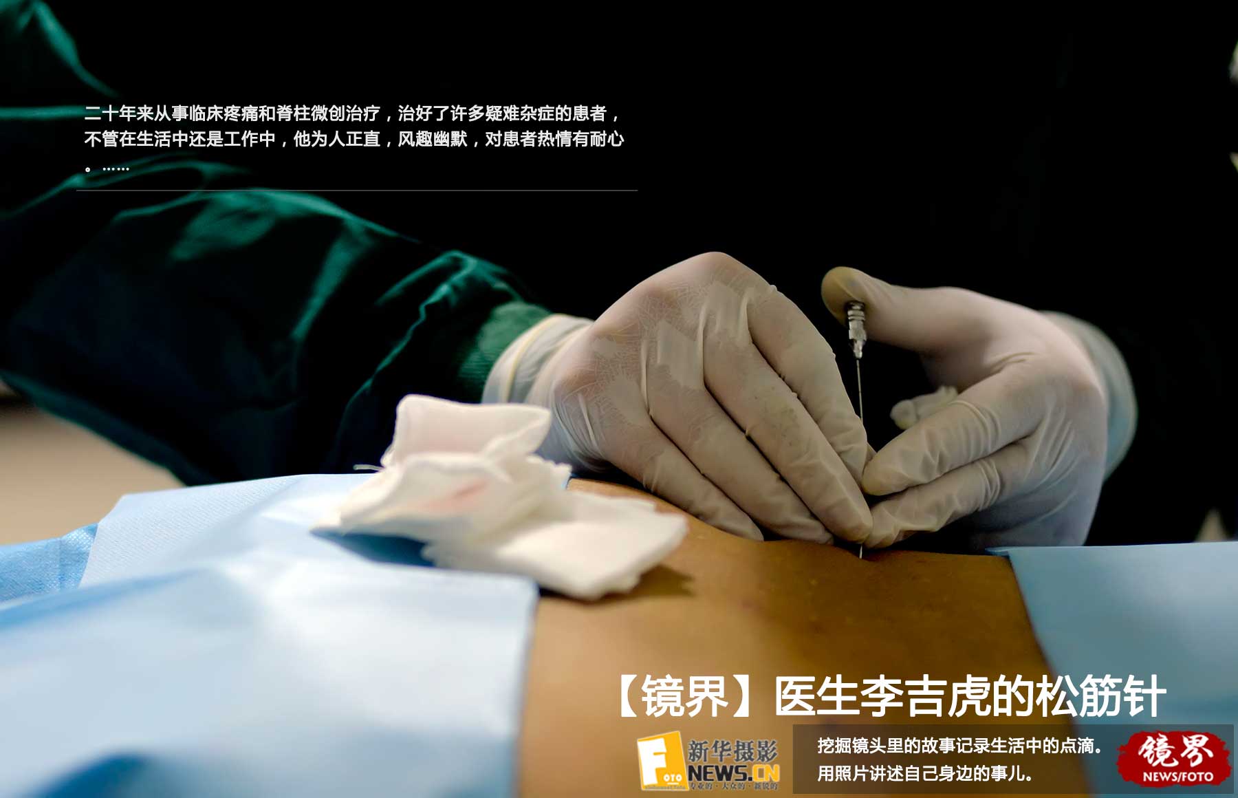 【镜界】医生李吉虎的松筋针