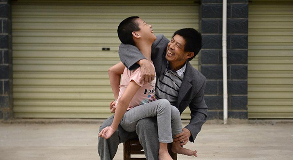 每天喝一斤白酒止痛的脑瘫女孩