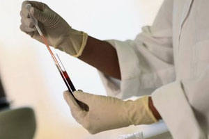 你身边的十四项癌症之最