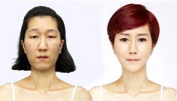 韩国“大妈脸”女子整容后变美女【图】