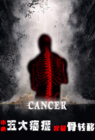 小心！这五大癌症容易骨转移