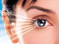 激光手术治近视安全性引争议
