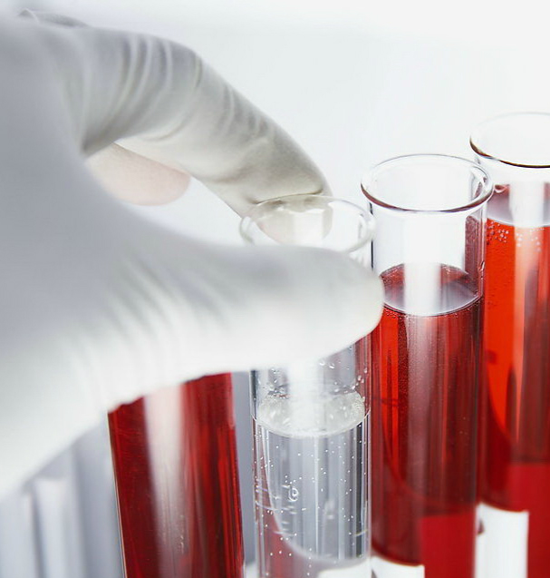 我国慢粒发病年龄偏低 定期监测意识需提高