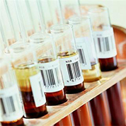 血脂升高要重视并早治