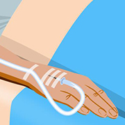 【图解】安全输液看过来 专家详解我国首部输液专家共识