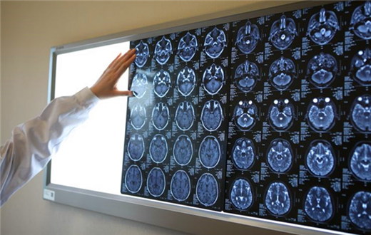 赛诺菲：多发硬化症药物特立氟胺片等三款新产品有望今年上市