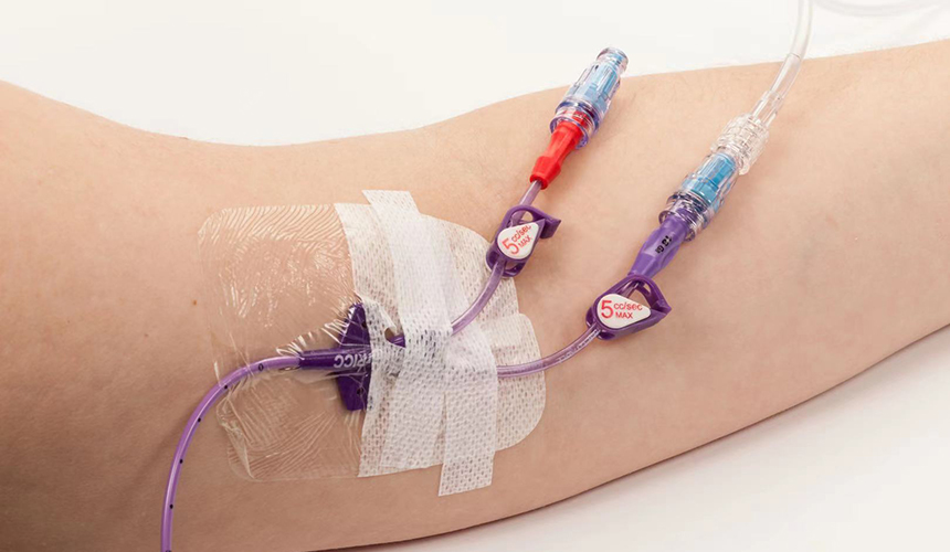 中心静脉导管是患者的“生命线”