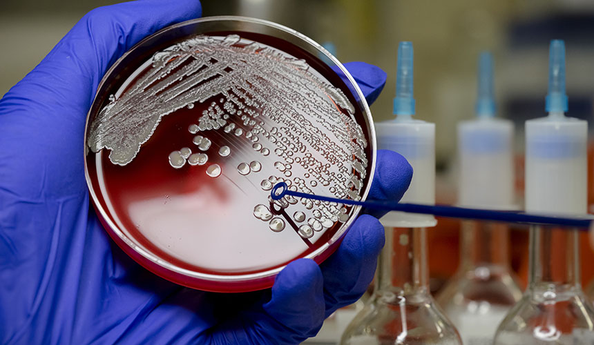 血管内导管感染的“三重风险”