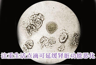 专家：注重生活点滴可延缓肾脏功能恶化