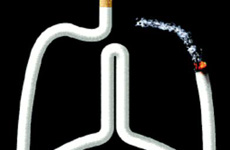 美国癌症协会：老烟民每年要做肺CT