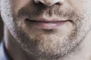 胡须移植打造完美男性魅力