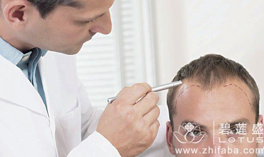 发际线调整手术价格多少钱