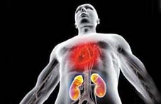 &ldquo;肾脏&mdash;&mdash;生命之本：关注急性肾损伤&rdquo;