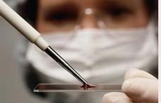 急性肾损伤 恐成&ldquo;流行病&rdquo;