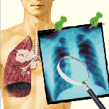 细胞免疫治疗 14天改写生命轨迹