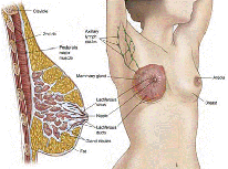 细胞免疫治疗挽救乳腺浸润性导管癌患者