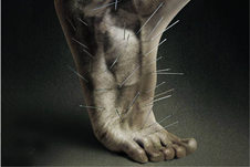 神经病理性疼痛的危害和治疗