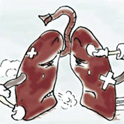 肺癌怎么治 关键看分期