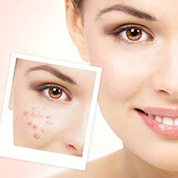 身体毒素的表现