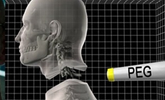 换头术在古籍多次出现