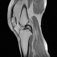 军医提醒:膝关节疼痛不仅是多休息那么简单