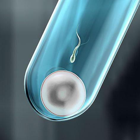 辅助生殖技术生育-高龄盼孕女性的福音