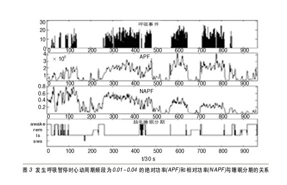 床垫式自然睡眠检测系统