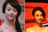 被疑整容90后女星 郑爽周冬雨变化惊人