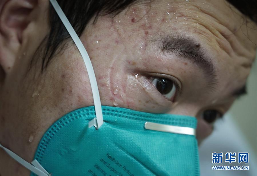 （聚焦疫情防控）（5）“最美印痕”