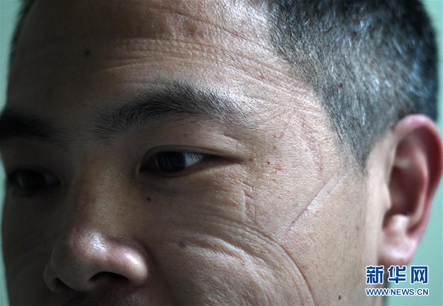 （聚焦疫情防控）（8）“最美印痕”