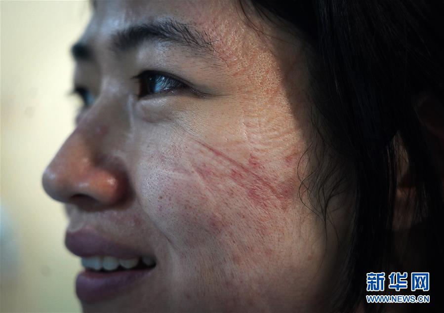 （聚焦疫情防控）（9）“最美印痕”