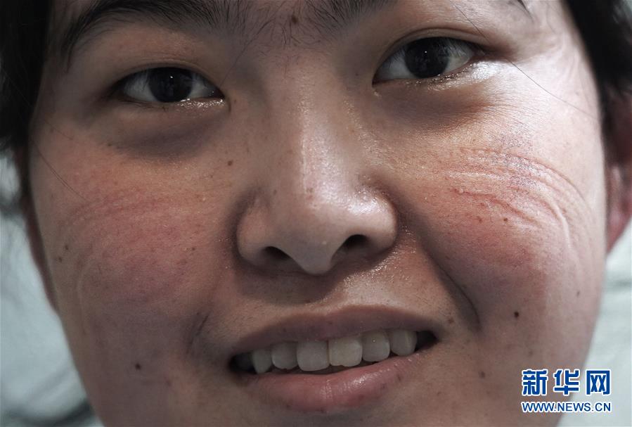 （聚焦疫情防控）（10）“最美印痕”