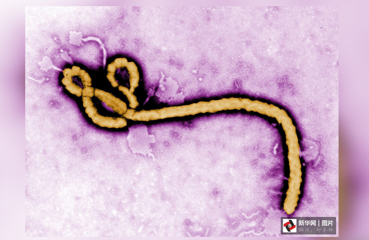致命的美丽:显微镜下的病毒粒子-百态