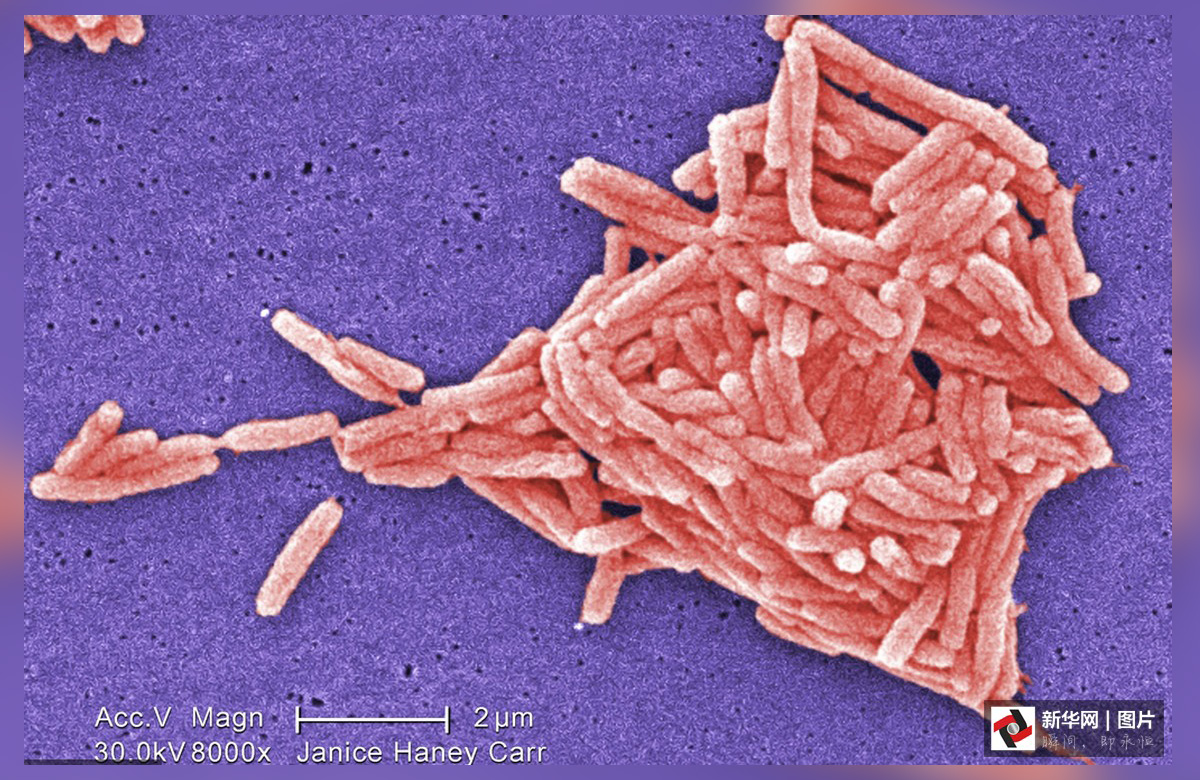 致命的美丽:显微镜下的病毒粒子-百态