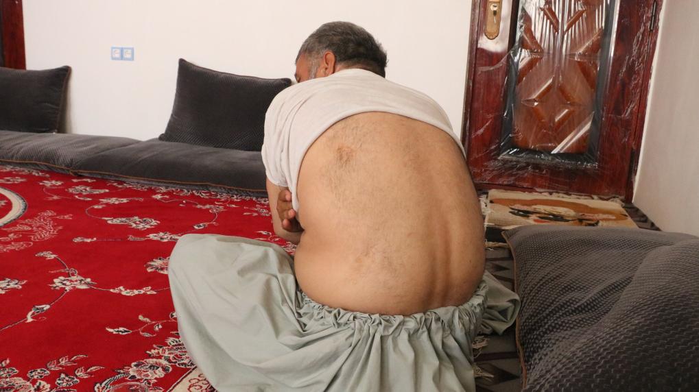 通讯：&ldquo;没有人道歉或赔偿&rdquo;&mdash;&mdash;阿富汗受害者控诉美军使用集束炸弹