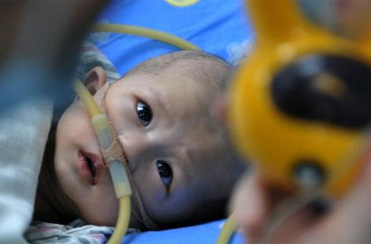 雷冬竹代表：降低出生缺陷，提高人口素质