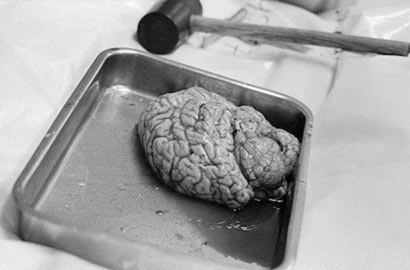 膽小慎入！實拍真實法醫解剖室