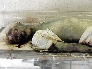 盤點人類歷史上十次最嚴重的瘟疫