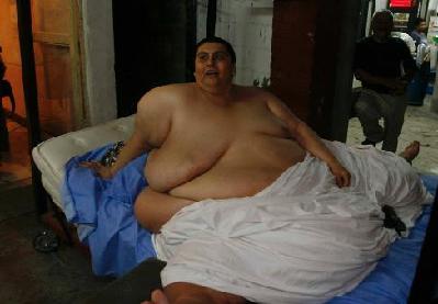 世界最胖男人因病去世 曾連續9年臥床