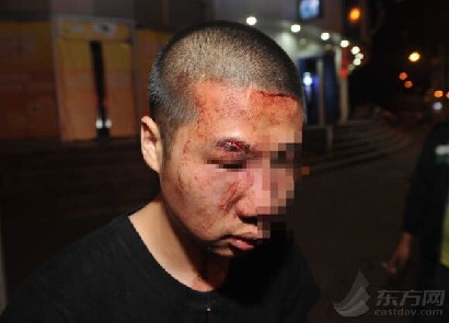 乘坐出租車遇飛來橫禍 市民遭老外無端暴打一分鐘